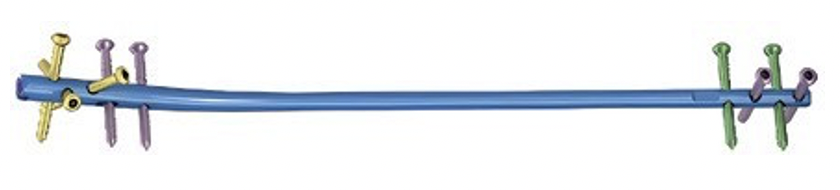 Інтрамедулярний стрижень для великогомілкової кістки Jinlu